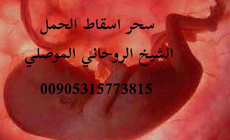اعراض سحر ا سقاط الحمل الموصلي 00905315773815